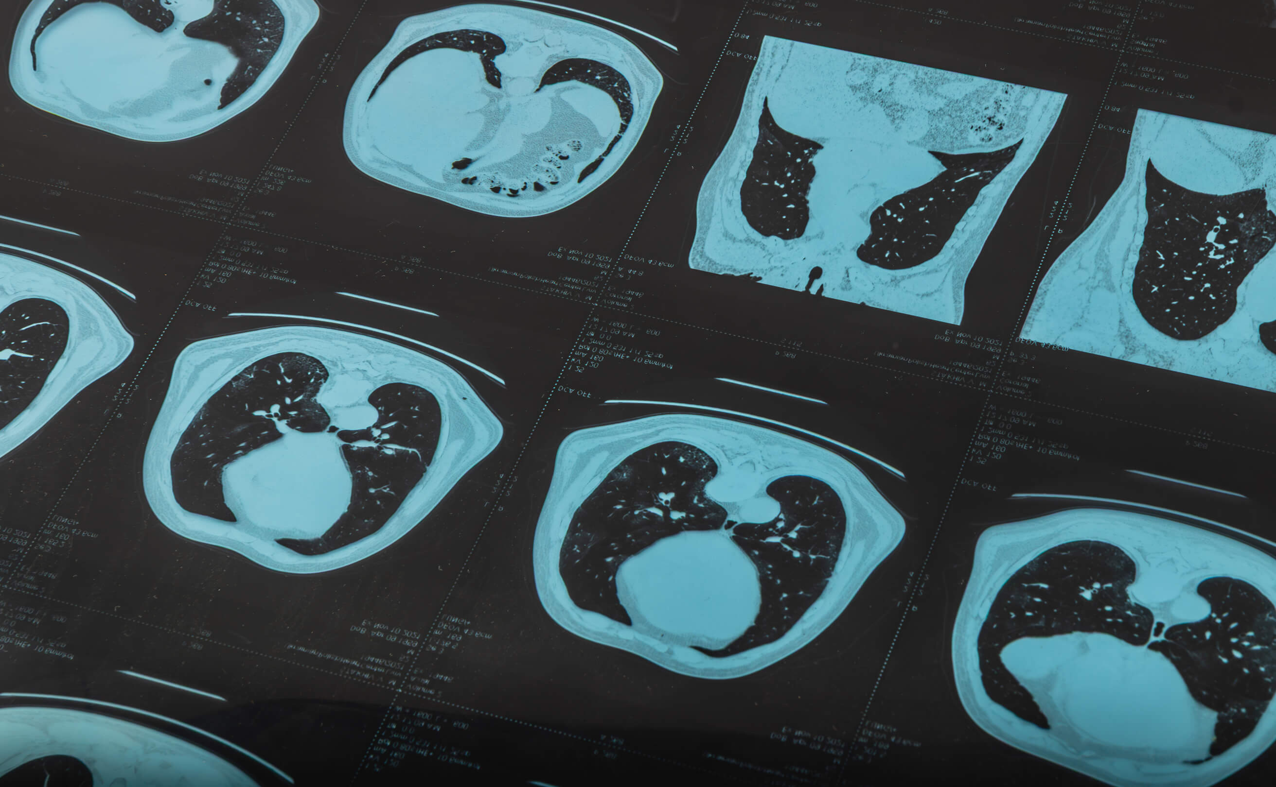 A close up of an imaging scan.